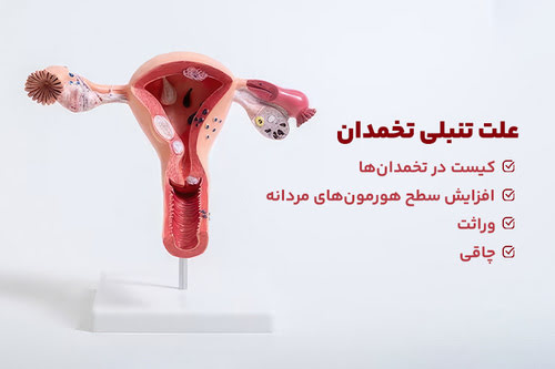 علائم تنبلی تخمدان